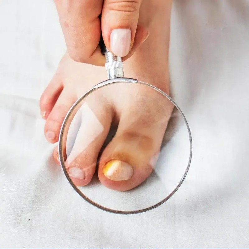 Crema Para El Cuidado De Las Uñas
