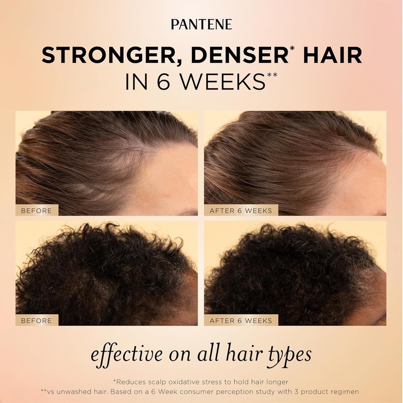 Pantene Abundant & Strong Daily Scalp Serum, Strengthens Scalp's Hold