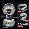 Modelo de implante de dientes, para enseñanza, modelo de enfermedad,