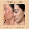 Tónico Facial Lumi Radiance+jabón Adiós Manchas Farmasi