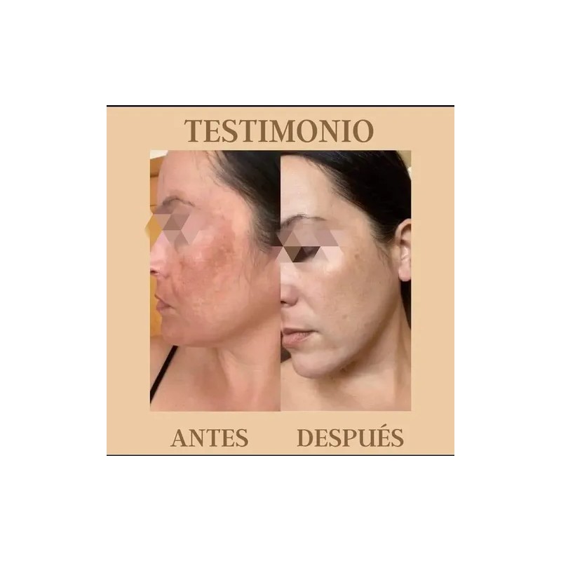 Tónico Facial Lumi Radiance+jabón Adiós Manchas Farmasi
