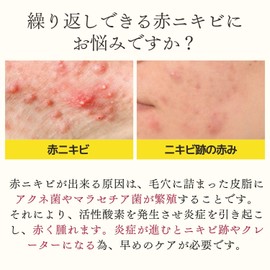 Dr. Re9 (Medicinal) Berlian Acne Care VC Lotion (Soothes Adult Acne, Red Acne, Inflammation Acne, Leaves No Trace of Acne), Allantoin Oil-Soluble Vitamin C Formulated