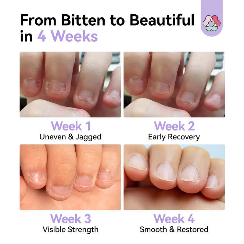SAVILAND Nail Biting Prevention Extreme Bitter 0.51 oz/15ml: Stop Biting