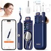 Ear Wax Removal Tool Camera - Safe and Effective Ear