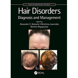 Hair Disorders: Diagnosis and Management (Series in Dermatological Treatment)