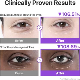 numbuzin Parches Para Ojos N.° 9 Parches De Colágeno Nad+ Para El Contorno De Ojos Ojeras, Efecto Refrescante, Reduce La Hinchazón, Arrugas Con Péptidos, Cafeína Y Niacinamida Reafirmante Y Volu
