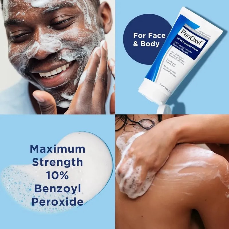 Jabón Espumoso Para Acné Panoxyl Con Peróxido De Benzoilo, 1