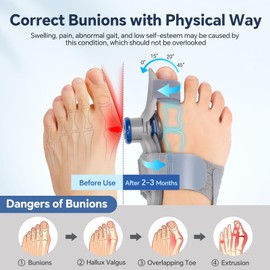 ROHVEMJ Bunion Corrector for Women & Men – Single Toe Straightener with Adjustable Alignment Knob & Silicone Pad, Day & Night Use, Fits Left or Right Foot