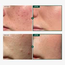 TOSOWOONG Madagascar Centella 86% Ampoule with 860,048ppm Centella Asiatica, Soothing, Calming, Facial Serum for face, for All Skin Types, Korean Skin Care, 100ml, 3.38 fl.oz.