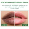 Lip Lightening For Dark Lips, Lip Balm Lips Pink Bleaching