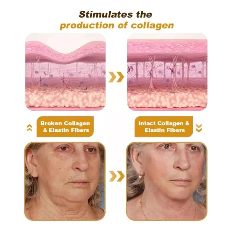 Jlt Crema Removedora De Arrugas Furzero Bot Ff