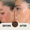 Crema Aclaradora Y Loción Quita Paño Manchas Acné Sol