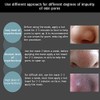 BIOAQUA Blackhead Remover Black Spots Mask Nose Pilaten Acne Purifying