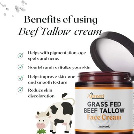 Beef Tallow Face Moisturizer - Grass Fed Beef Tallow for Skin Care- unscented Handmade Tallow face Cream- tallow balm Sensitive & Dry Skin, Eczema, Psoriasis, sunburn (FRANKINCENSE)
