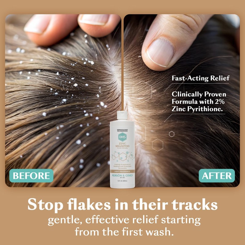 DHS Zinc Shampoo – Dandruff Shampoo – for Flaky and
