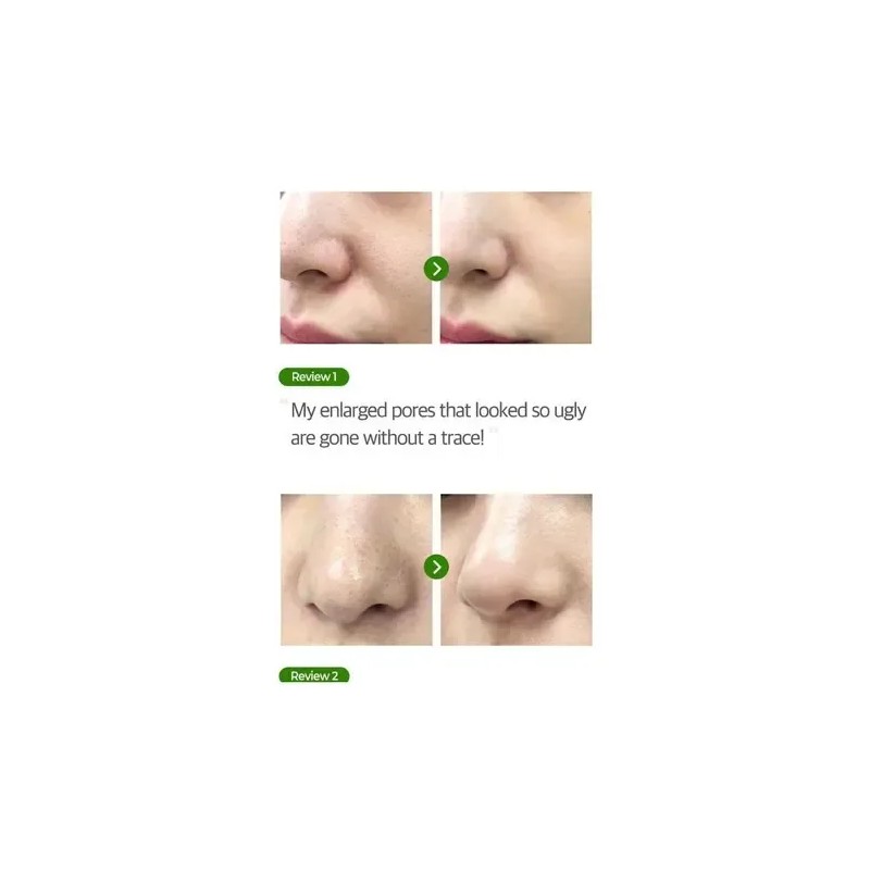 Tónico Facial Some by Mi Super Matcha 150ml Cierra Poros
