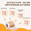 NAYSAYE Silicone Scar Tape, Silicone Scar Sheets for Surgical Scars,