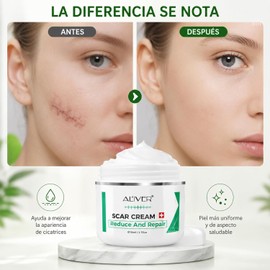 Crema Cicatrices y Estrías 50g Reduce Marcas de Acné, Quemaduras y Cirugías Hipoalergénica, Sin Parabenos, Cruelty Free, Apta Todo Tipo de Piel