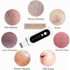 Depurador de Piel Facial, Limpiador Facial Ultrasónico, con 5 Modos
