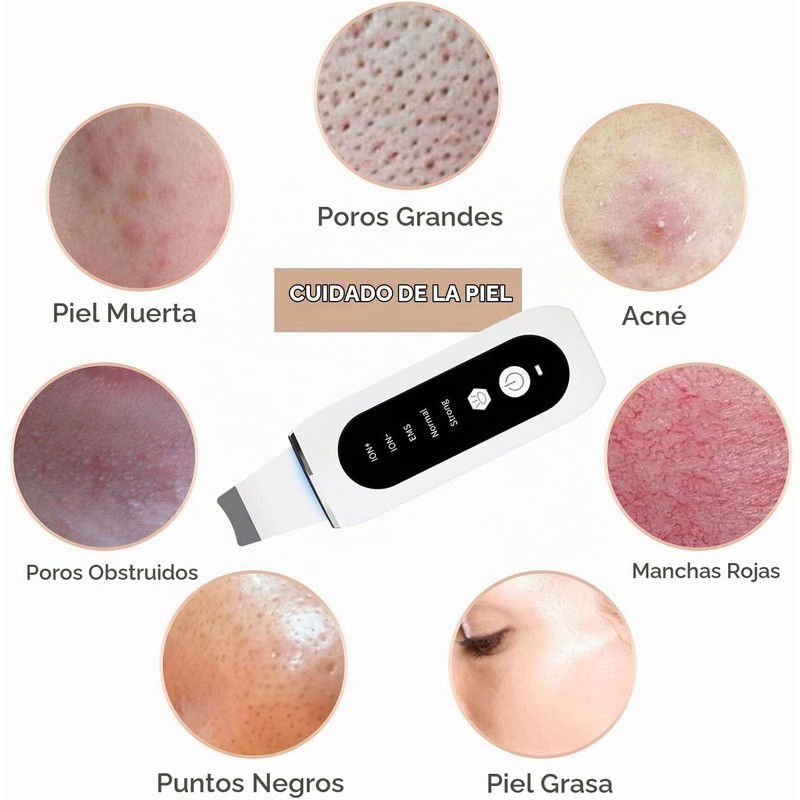 Depurador de Piel Facial, Limpiador Facial Ultrasónico, con 5 Modos