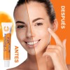Crema Despigmentante Antimanchas Vit C Arbutina