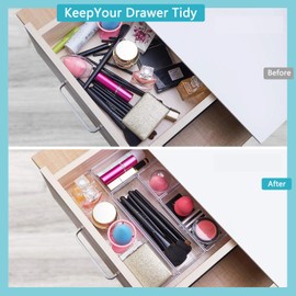 15 PCS Clear Plastic Drawer Organizer Set, 3 Sizes Desk Drawer Divider Organizers and Storage Bins for Makeup, Jewelry, Gadgets for Kitchen, Bedroom, Bathroom, Office