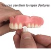 Gum Material - for Repairing Missing Teeth and Smile Improvement.