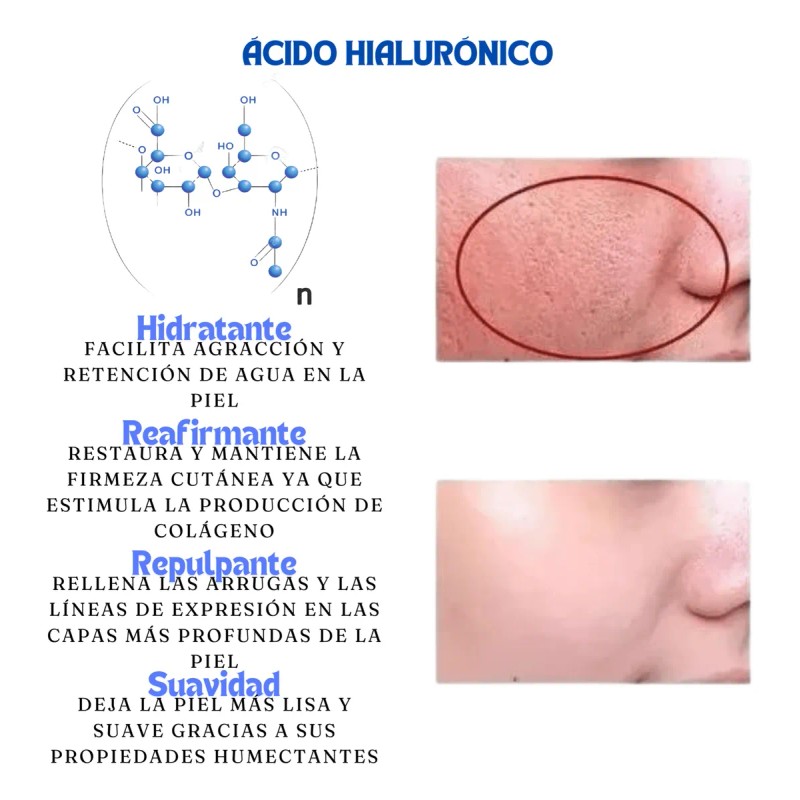 Ácido Hialurónico Facial + Parches Hidratantes Frente Kit