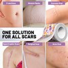 SLGCBL Silicone Scar Sheets, Reusable Silicone Scar Tape Roll for
