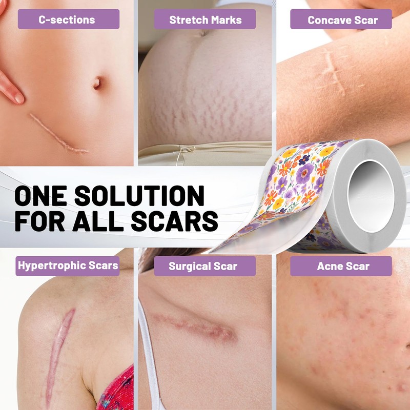 SLGCBL Silicone Scar Sheets, Reusable Silicone Scar Tape Roll for