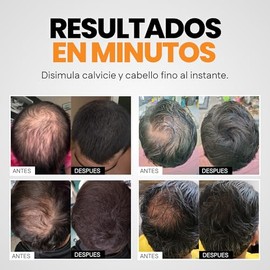 Henrys Kit Fibras Capilares Negro 27.5g con Aplicador, Disimula reas con Poco Cabello, Aumenta Volumen y Densidad al Instante                         