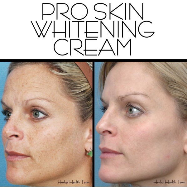 SKIN WHITENING CREAM best results! also treats acne & scars - Large bottle 125ml