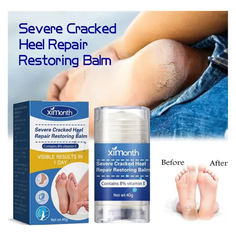 Be - 2×crema Reparadora Grietas Secas Y Talones For Pies