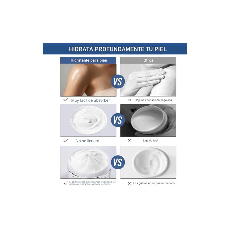 Cremas Hidratante para Pie, 50g Urea Crema, Crema para Pies,