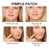 🔥 300pzs mascarillas estrella para el acne espinillas granos Vitaminas