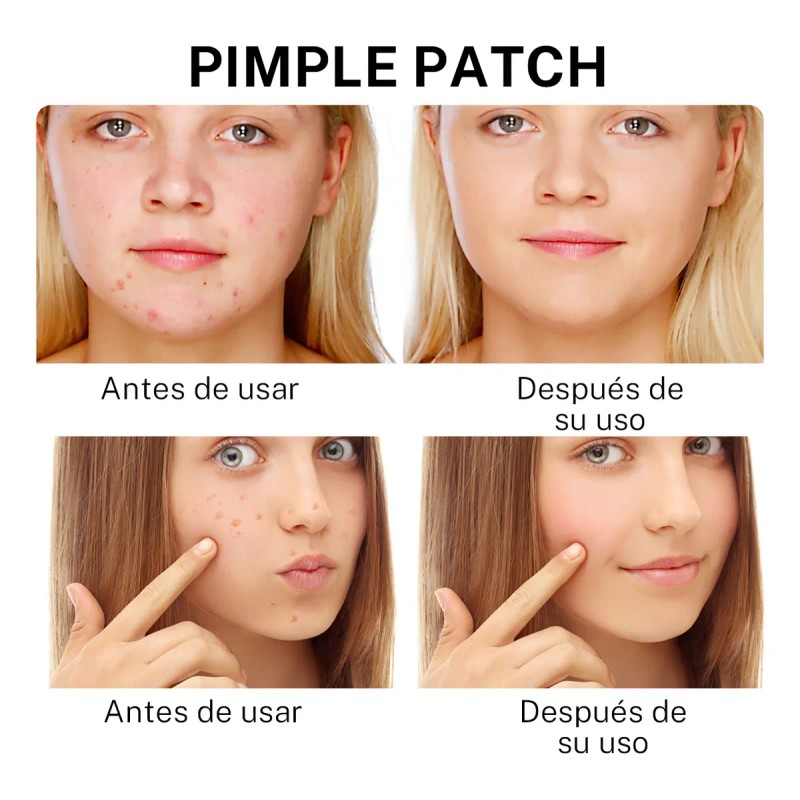 🔥 300pzs mascarillas estrella para el acne espinillas granos Vitaminas