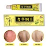 Vendedor Oficial - Crema Herbal China - Alivio Natural Para