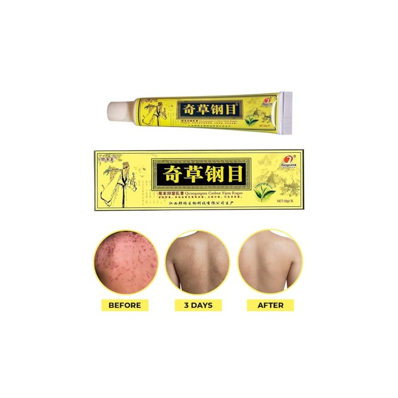 Vendedor Oficial - Crema Herbal China - Alivio Natural Para