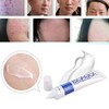 Bioaqua Acne Cream Cicatrices Poros Control De Grasa 1 Pzs