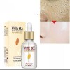 Serum Suave Blanquea Piel Aclara Suaviza Poros Moda Coreana Normal