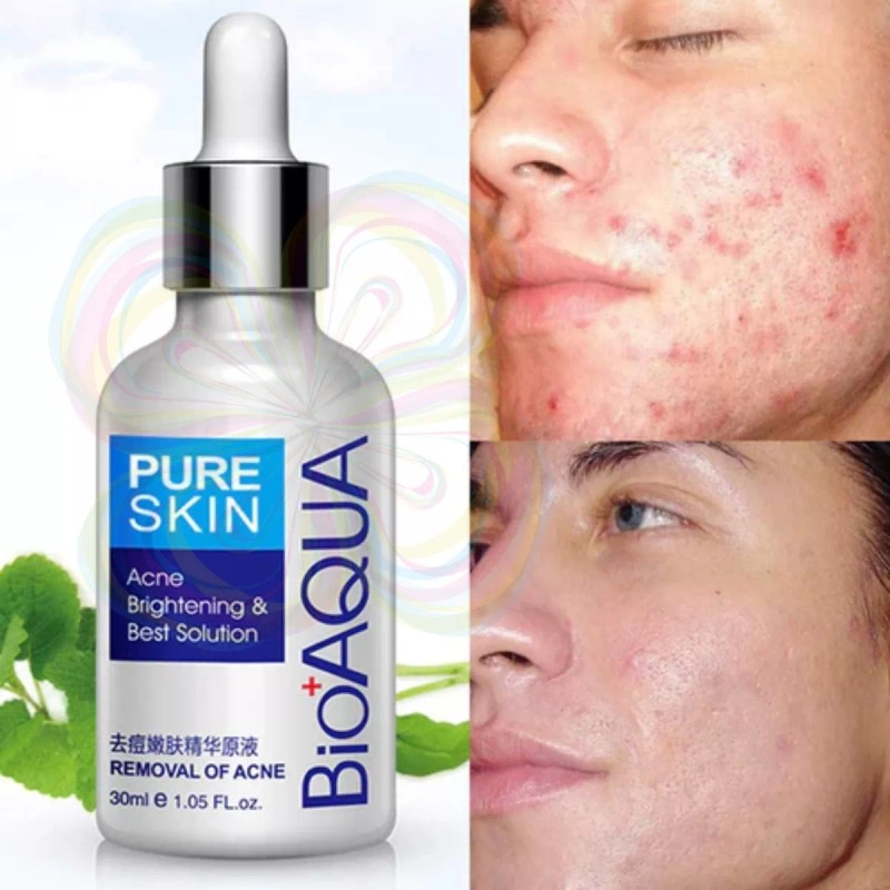 Bioaqua Crema+ Serum Bioaqua Pure Skin Tratamiento Anti-acne Manchas