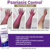 TriDerma “Crema Facial Y Corporal Para El Control De La