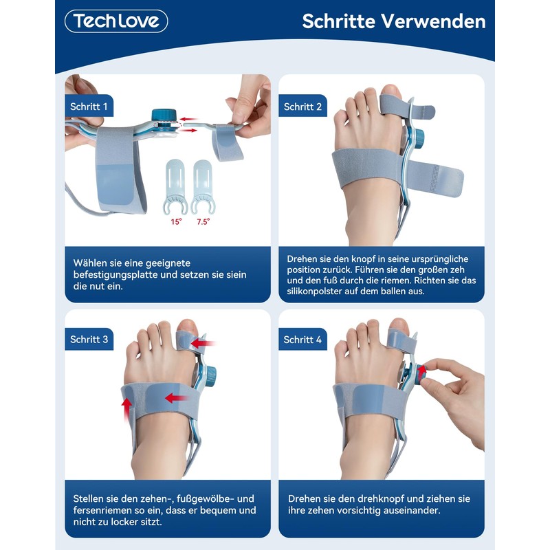 Tech Love Hallux Valgus Correction Fixing Plate Upgrade Double Tension