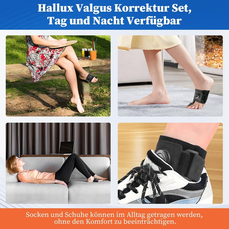 PNGOS Hallux Valgus Correction for Right, Adjustable Button, Hallux Valgus