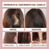 Aceite De Batana For El Crecimiento Del Cabello Con 60ml