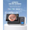 ScopeAround 4.5-inch IPS Color Screen Digital Otoscope 1.0MP 1080P 3.9mm