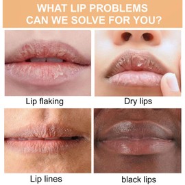 ARCHIDATE 2Pcs Turmeric Lip Balm for Dark Lips, Natural Turmeric Moisturizing Lip Balm for Smokers, Long-Lasting Moisturize Nourishes Softens Dry Chapped Dull Lips, Reduce Lips Lines