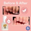 Tratamiento Para Morderse Las Uñas Ella+mila No More Biting