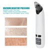 Blackhead Removal Cleaner Electric Face Nose Acne Whitehead Extractor Vacuum
