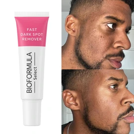 The Fast Dark Spot Remover